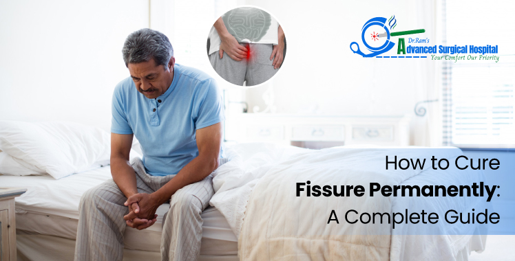 How to Cure Fissure Permanently: A Complete Guide