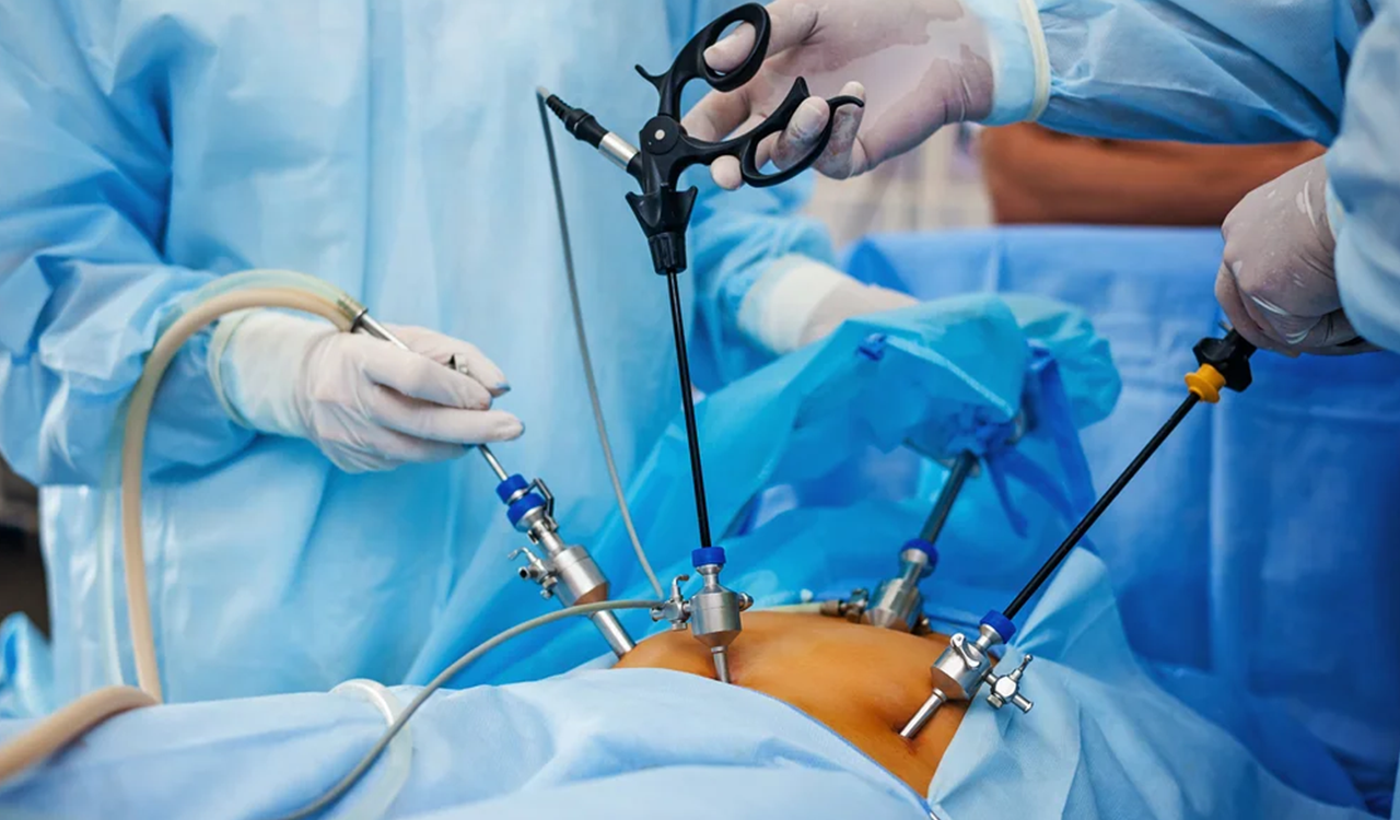 Laproscopic Surgery