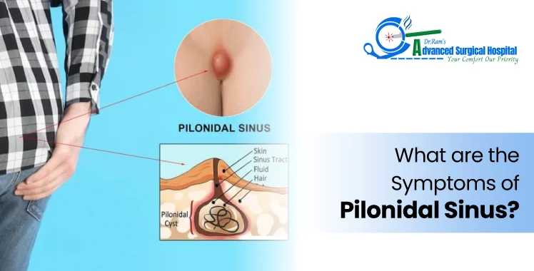 What Are the Symptoms of Pilonidal Sinus?