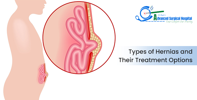 Which Doctor Should You Consult for a Piles Problem?