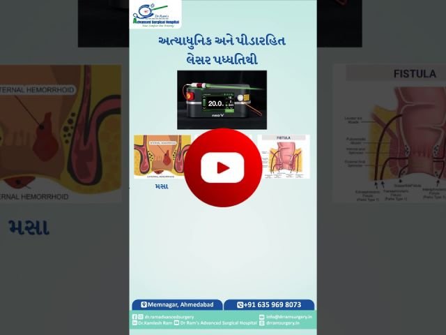 piles free gujarat